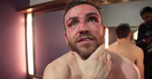Video | Matthew Macklin Reacts to Disappointing KO Defeat
