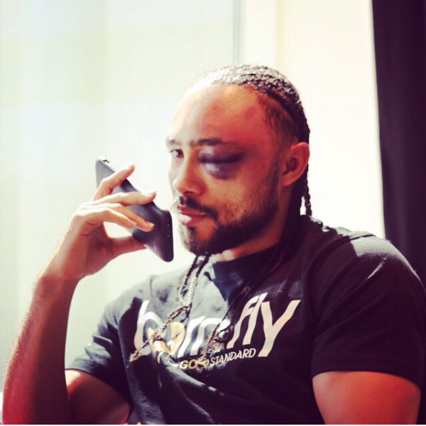 Thurman Shares Next-Day Photo after War with Guerrero