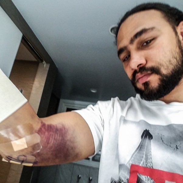 Keith Thurman Out 6 Months After Surgery